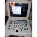 2D portable ultrasound machine and ultrasound scanner laptop